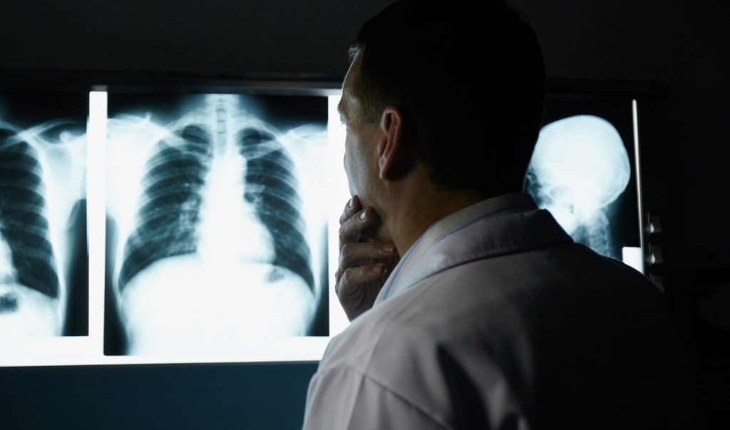 Doctor working in hospital during examination of x-rays
